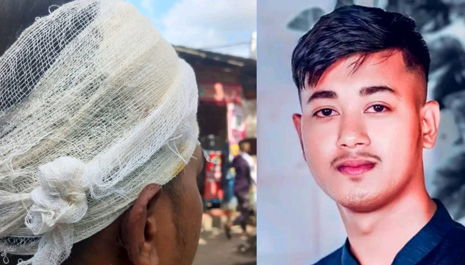 বড়লেখায় ১৭০ টাকা পাওনা নিয়ে হামলার অভিযোগ, গুরুতর আহত যুবক হাসপাতালে