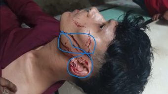 ভ্যান সরানো নিয়ে বিরোধের জেরে যুবকের ওপর হামলার অভিযোগ