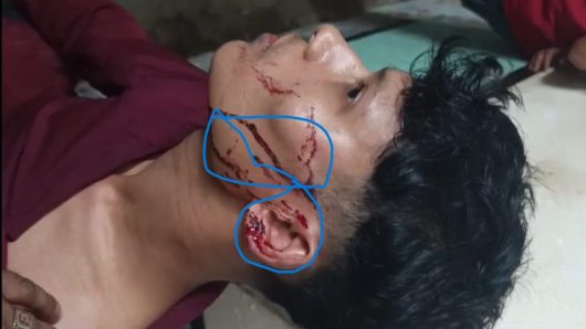 ভ্যান সরানো নিয়ে বিরোধের জেরে যুবকের ওপর হামলার অভিযোগ