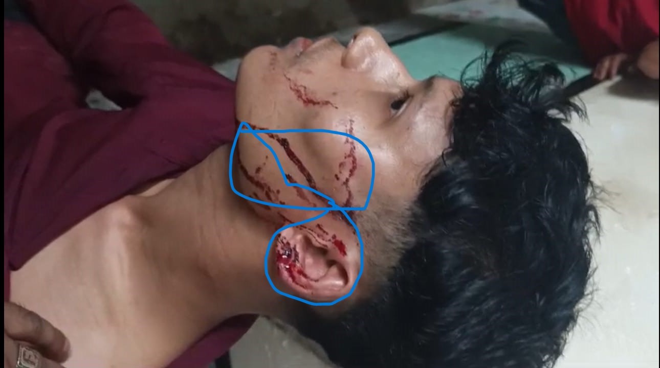 ভ্যান সরানো নিয়ে বিরোধের জেরে যুবকের ওপর হামলার অভিযোগ