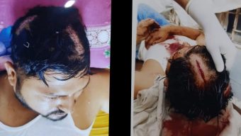 নগরীর মেন্দিবাগে রেস্টুরেন্টের সামনে আওয়ামী ডেবিলদের হামলায় যুবক  আহত ১ লাখ ৫ হাজার টাকা ছিনতাই থানায় অভিযোগ