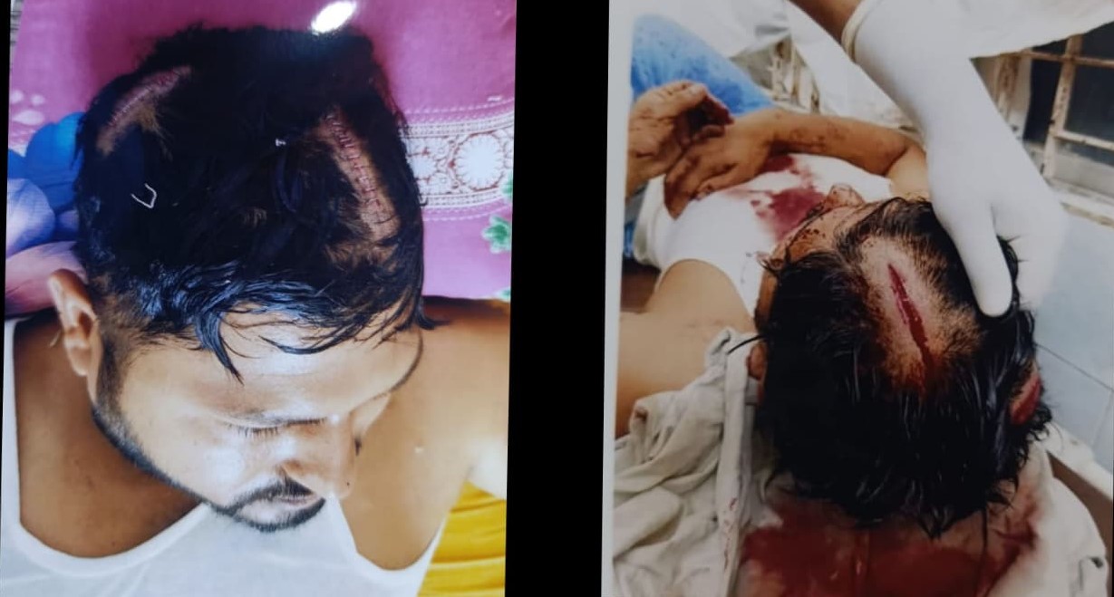 নগরীর মেন্দিবাগে রেস্টুরেন্টের সামনে আওয়ামী ডেবিলদের হামলায় যুবক  আহত ১ লাখ ৫ হাজার টাকা ছিনতাই থানায় অভিযোগ