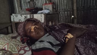 কোম্পানীগঞ্জে অসহায় নারীকে ধর্ষণের চেষ্টার অভিযোগ, গুরুতর আহত