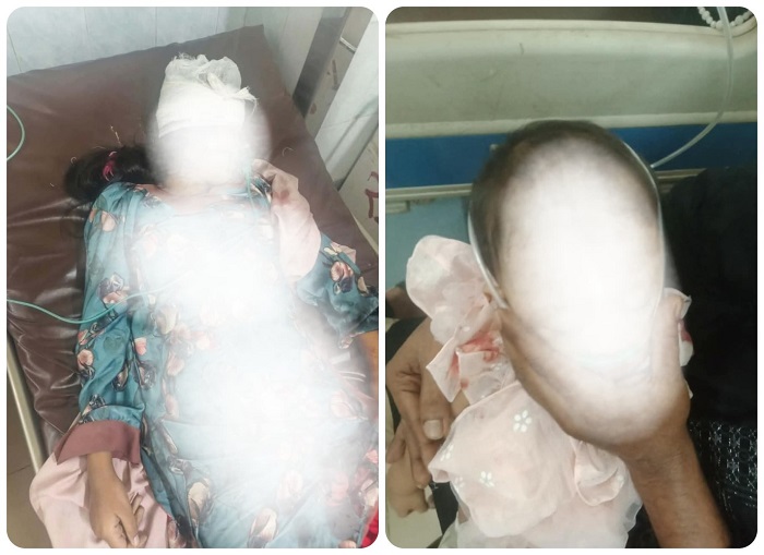 সাদাপাথর বাসের ধাক্কায় মা-মেয়ে নিহত