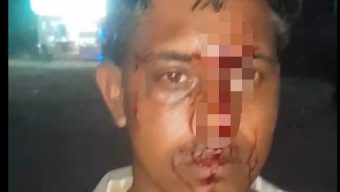 জাফলংয়ে বেড়াতে গিয়ে হামলার শিকার জৈন্তাপুরের দুই প্রবাসী, মোবাইল-মানিব্যাগ ছিনতাইয়ের অভিযোগ