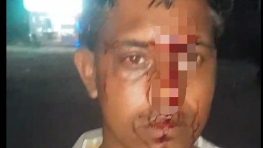 জাফলংয়ে বেড়াতে গিয়ে হামলার শিকার জৈন্তাপুরের দুই প্রবাসী, মোবাইল-মানিব্যাগ ছিনতাইয়ের অভিযোগ