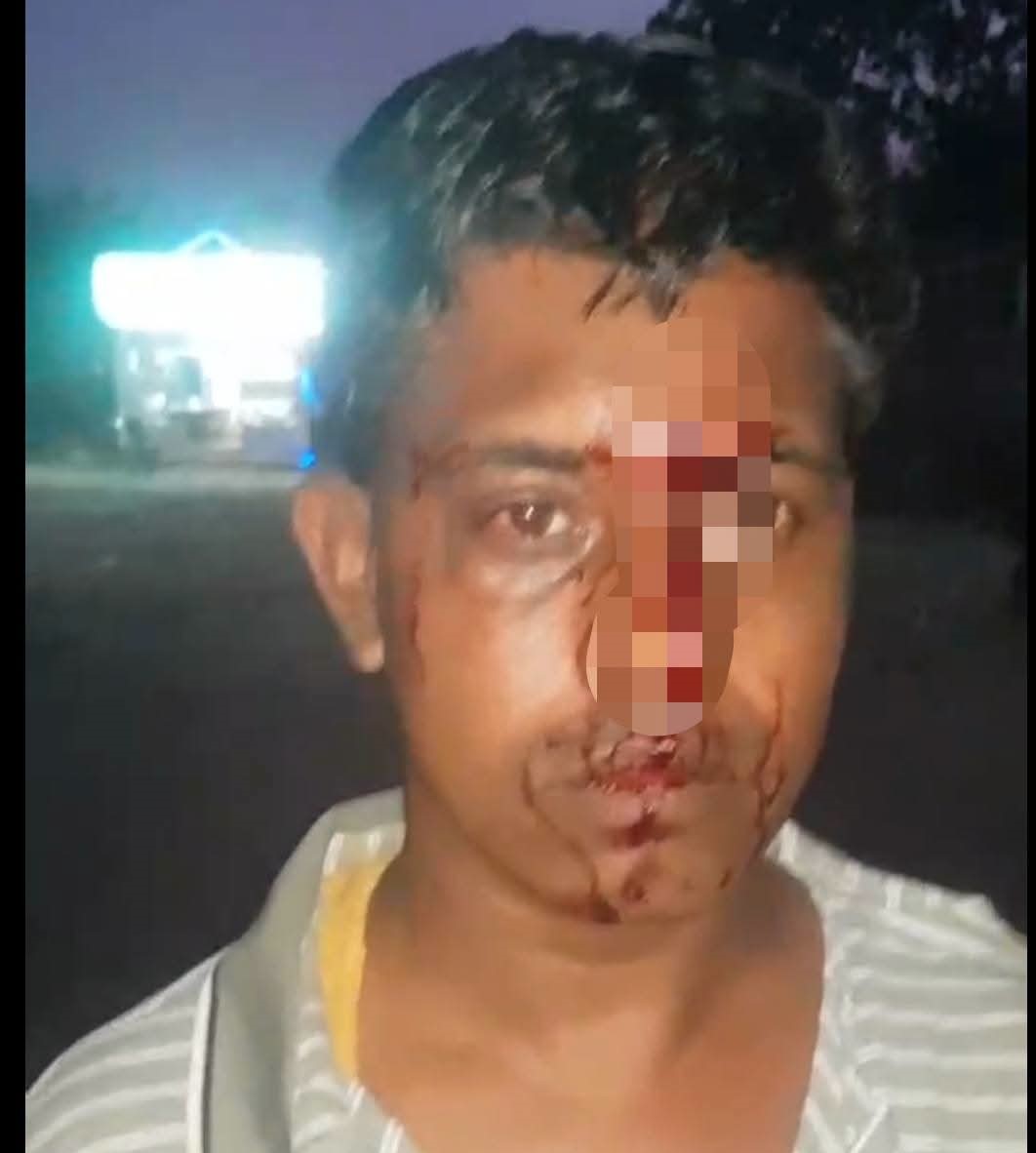 জাফলংয়ে বেড়াতে গিয়ে হামলার শিকার জৈন্তাপুরের দুই প্রবাসী, মোবাইল-মানিব্যাগ ছিনতাইয়ের অভিযোগ